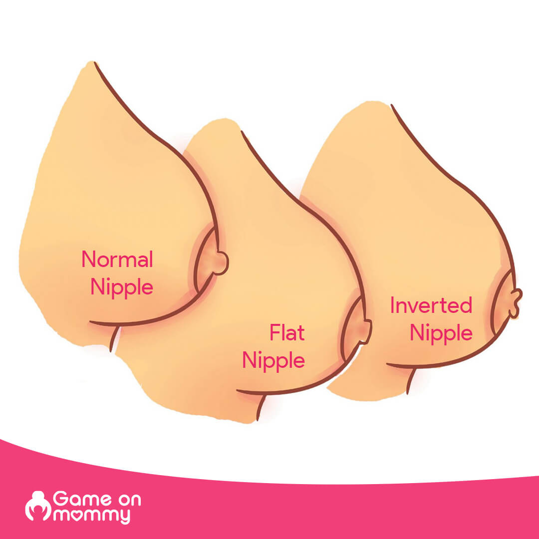 Nipple types